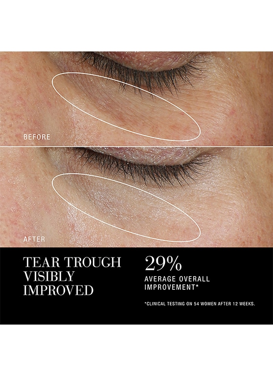 ReNutriv Ultimate Diamond Brilliance Eye Creme Set